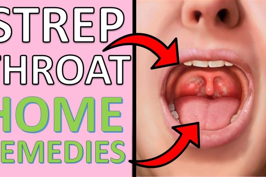 16 Poweful Home Remedies For Strep Throat | Causes, Symptoms & Treatment  For Strep Throats - Youtube
